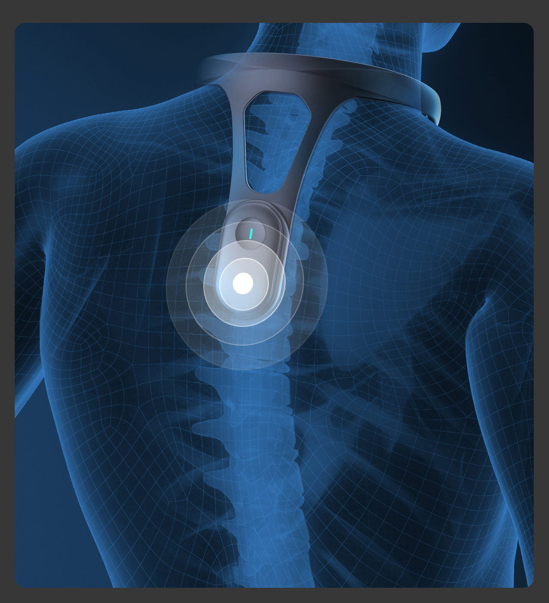 Posture Corrector Device