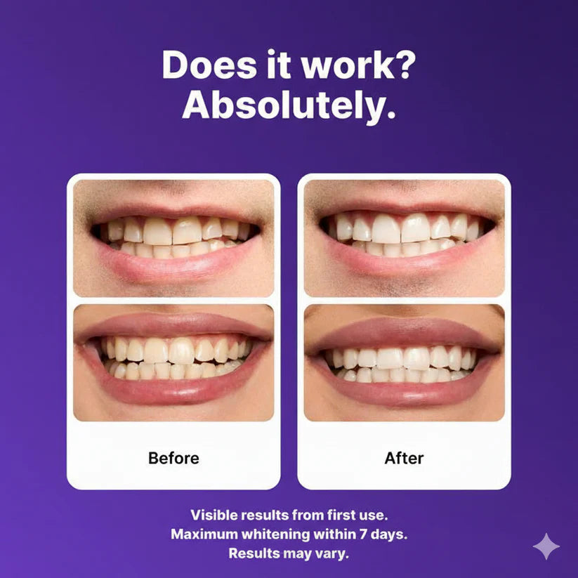 Purple Teeth Whitening Strips