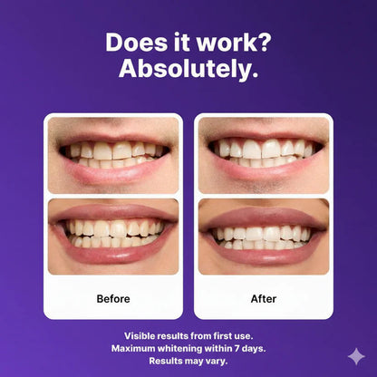Purple Teeth Whitening Strips