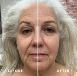 Asgord™ Lymphatic Face Brush